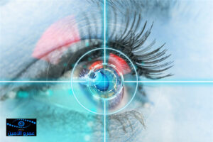 موانع عملية تصحيح النظر بالليزر: دليل طبي شامل 2026 21 تكلفة عملية المياه البيضاء بالليزر