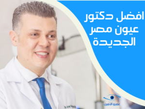 احجز لدى افضل دكتور عيون في مصر الجديدة 2022