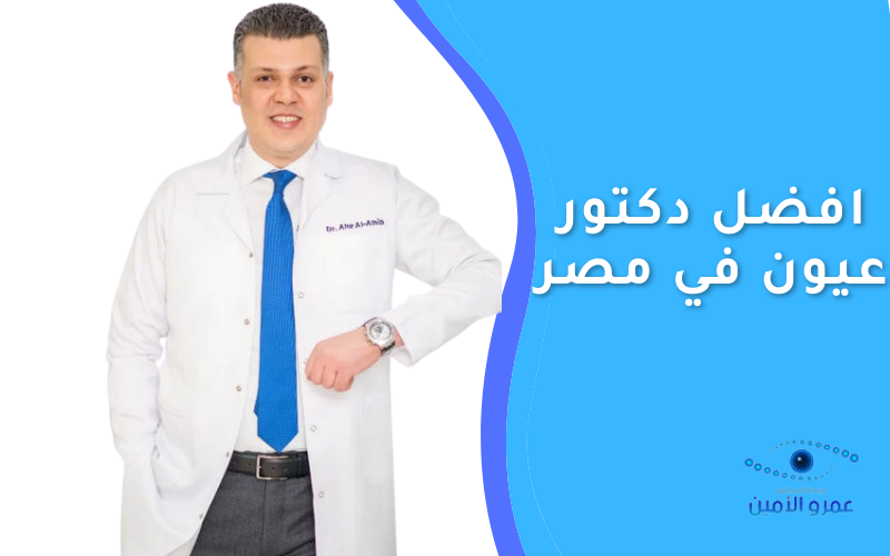 افضل دكتور عيون في مصر