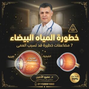 خطورة المياه البيضاء على العين