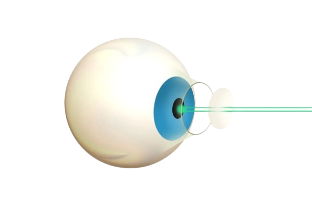 خرافات العيون
